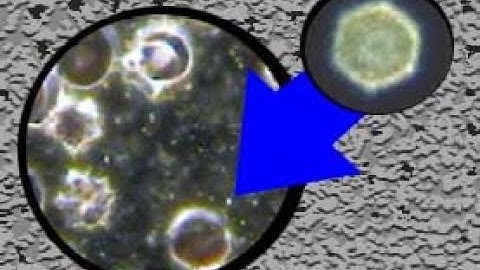 BLOOD TEST: MICROZYMAS (ENDOBIONT) in LIVE BLOOD in 4K