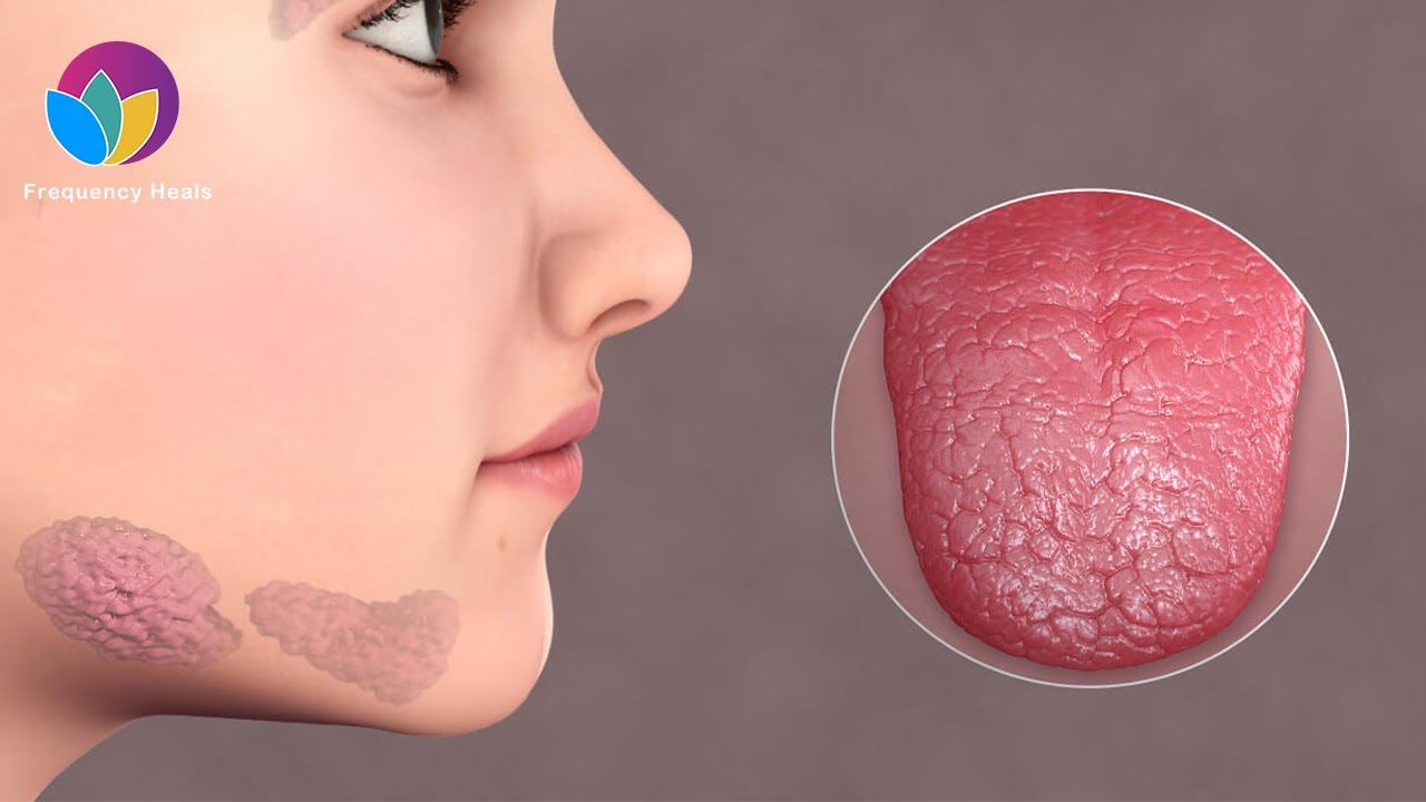 Sjogren’s Syndrome Relief Increase Fluid Secretion & Moisturize Your