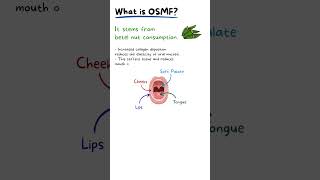 Oral Submucosis Fibrosis Explained
