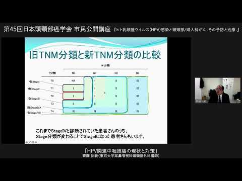 ヒトパピローマウィルス（HPV)関連中咽頭癌の現状と対策　第45回日本頭頸部癌学会　市民公開講座