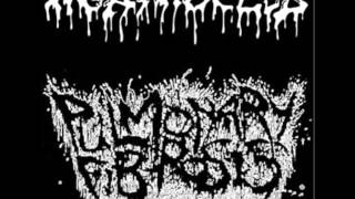 Pulmonary Fibrosis - Vomit Breath (Regurgitate Cover)