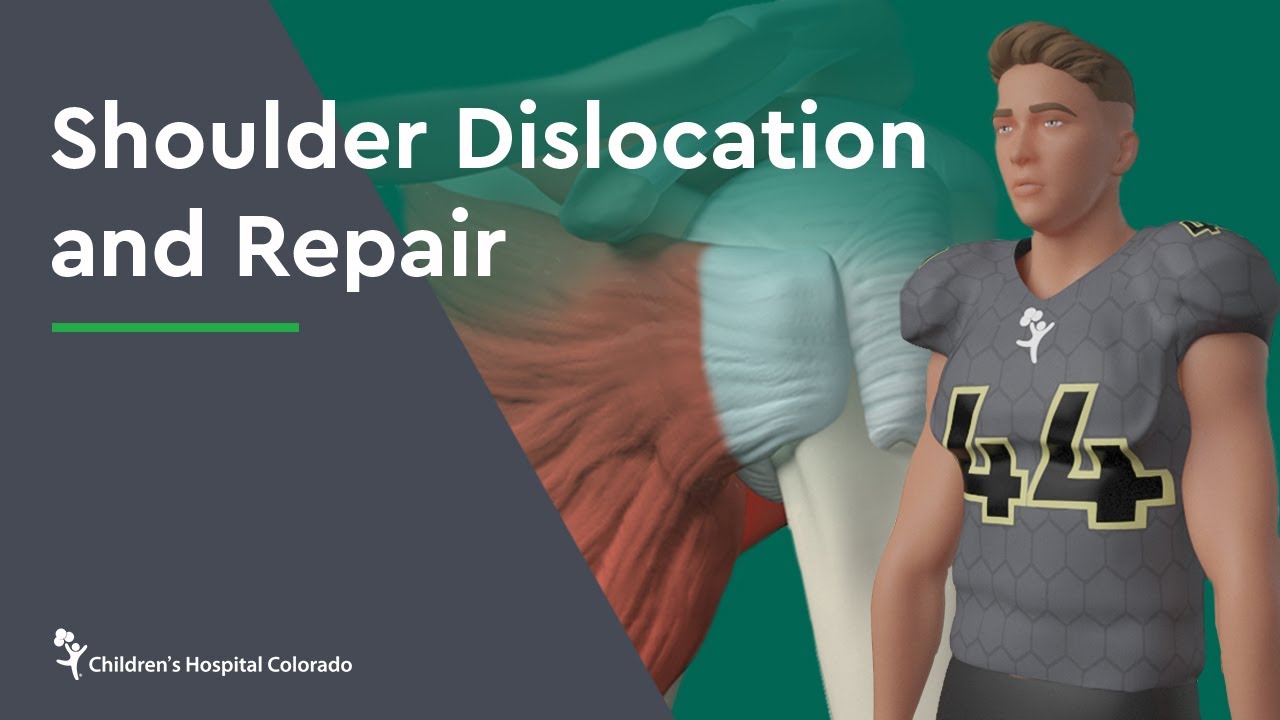 How Painful Is A Dislocated Shoulder?