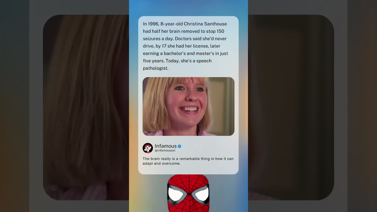 В 1996 году восьмилетней Кристине Сэнтхаус удалили половину мозга, чтобы остановить 150 припадков...