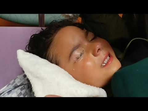 4 YEAR OLD GIRL SUPER GLUED HER EYE SHUT! (WARNING GRAPHIC)