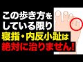 【注意⚠️】寝小指・内反小趾の人は膝が〇〇の歩き方をしている!?内反小趾を改善する歩き方｜鍼灸整体院リーフ｜足指ほぐし