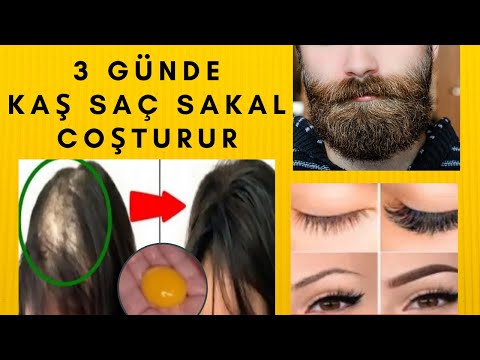 Video: Sebum istehsalında artım?