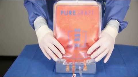 Puregraft Direct Harvest System In-Service Video