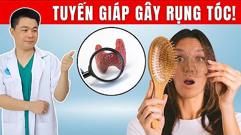 Rụng Tóc Nhiều Do Tuyến Giáp: Lý Do, Nguyên Nhân Và Phương Pháp Điều Trị | Bác Sĩ Chiều
