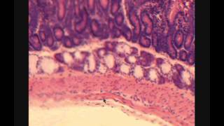 ДВЕНАДЦАТИПЕРСТНАЯ КИШКА.  DUODENUM. В световой микроскоп