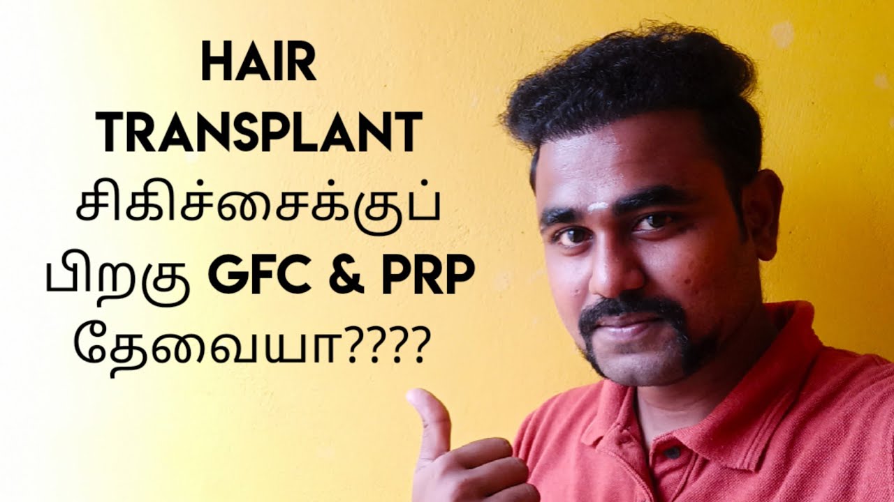 do-you-need-gfc-prp-after-hair-transplant-treatment-8-month-hair