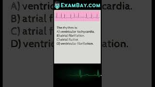 EKG\ECG Interpretation Practice Exam for Nursing NCLEX
