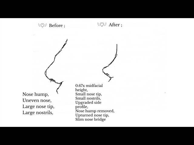 “ ᵛⁱʳᵗᵘᵃˡ ⁿᵒˢᵉ ˢᵘʳᵍᵉʳʸ “ ; Nose reconstruction subliminal ♡¸.•* Ultra Effective 🍥 class=