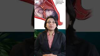 बचच क गल म नल नपटन स कय हत ह? जन