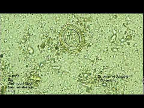 Hymenolepis nana- egg