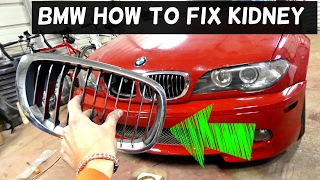 BMW LOOSE KIDNEY HOW TO FIX PERMANENTLY DEMONSTRATED ON E46