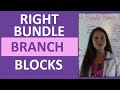 How to Interpret EKG Right Bundle Branch Blocks on ECG for Nurses