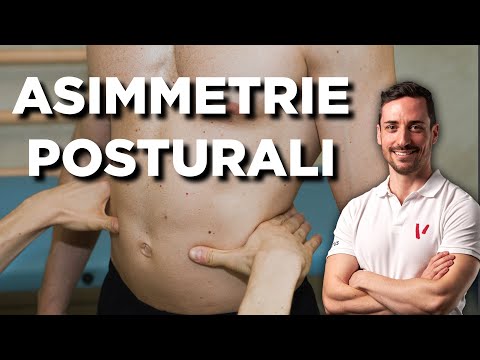 Asimmetrie posturali: cosa devi sapere