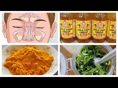 Best Natural Home Remedies For Sinusitis