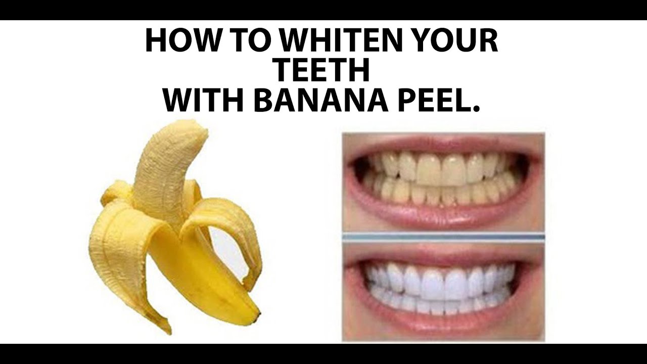 Waste To health- Using Banana Peel to Whiten your teeth