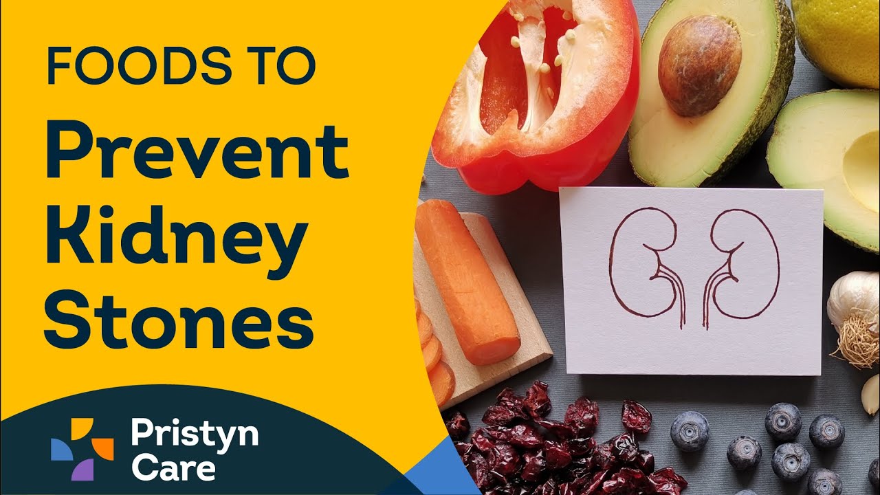Foods to Prevent Kidney Stones Pristyn Care Call For Free