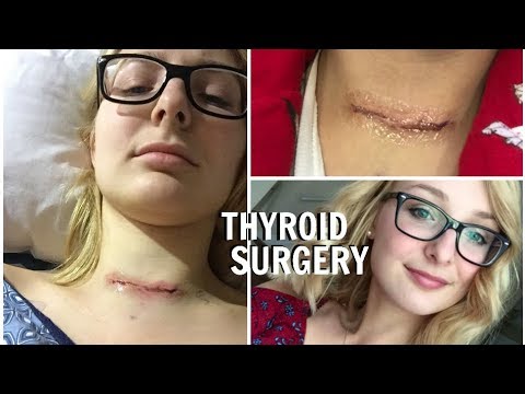 MY THYROID REMOVAL SURGERY + UPDATE!