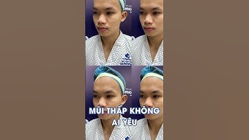 DÁNG MŨI L LINE CHUẨN PHÁI MẠNH AI NHÌN CŨNG MÊ #youtubeshorts