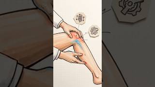 Hypertonia vs Hypotonia Explained