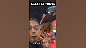 What to Expect You Get Your  Cracked Tooth Pulled Out | View Mobile Dental #shorts