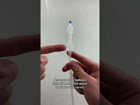 How Labor Is Induced Pregnancy Induction Methods Cervical Ripening Cook Balloon