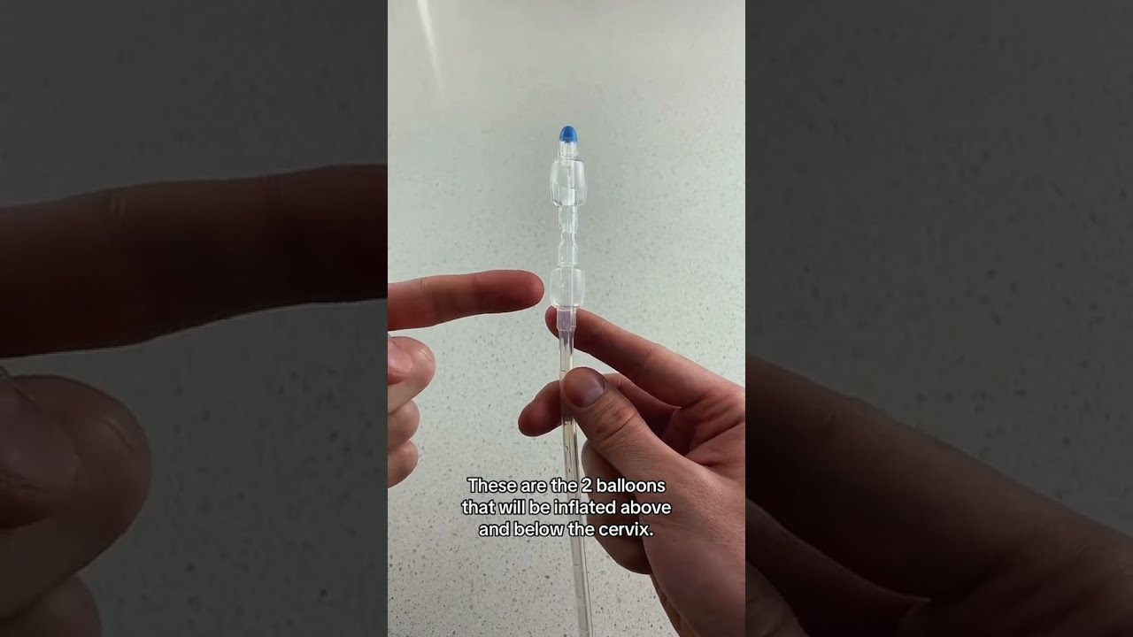 How Labor Is Induced Pregnancy Induction Methods Cervical Ripening Cook Balloon