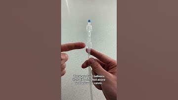 How Labor Is Induced (Pregnancy Induction Methods) - Cervical Ripening Cook Balloon