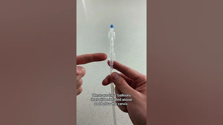 How Labor Is Induced (Pregnancy Induction Methods) - Cervical Ripening Cook Balloon