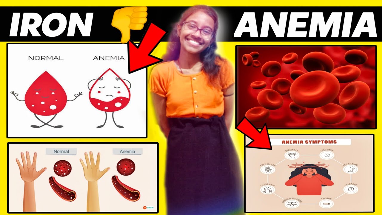 Iron Deficiency Anemia 🤩| Anemia | MSN | Bsc Nursing - YouTube