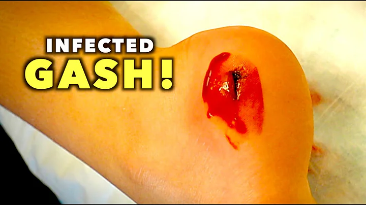 INFECTED GASH ON HER HEEL...(We Had to Deep Clean)...