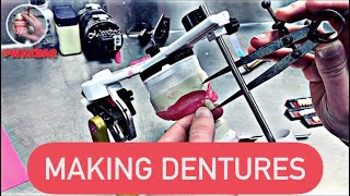 🔥HOW DENTURES ARE MADE (with description of steps) #waxbae🔥 #DENTURES #WAX