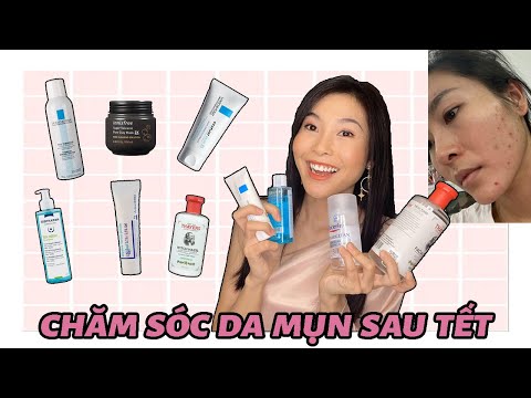 Phục hồi da MỤN , KÍCH ỨNG sau kì nghỉ Tết dài hạn nhất hành tinh 😪