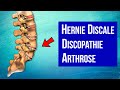 Hernie discale discopathie arthrose  mieux comprendre son mal de dos