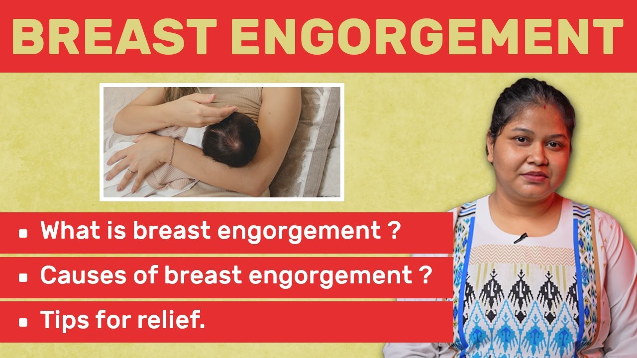 Breast Causes and Tips for Relief YouTube