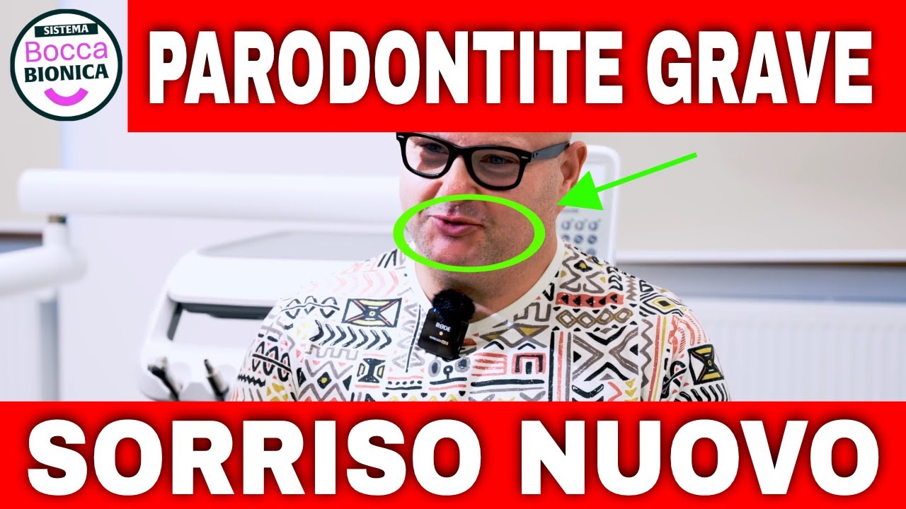 Parodontite grave: da una bocca insicura a un sorriso nuovo