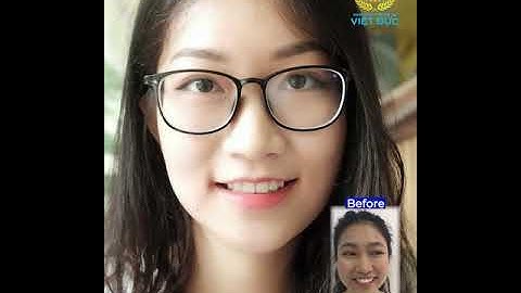 KHÔNG NHẬN RA CÔ GÁI NĂM ẤY SAU NIỀNG RĂNG - LỘT XÁC HOÀN TOÀN TẠI NKQT VIỆT ĐỨC