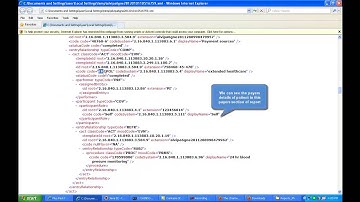 Chartwell PQRI Tutorial 2