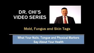 Dr Chi's Fingernail and Tongue Analysis - Mold, Fungus and Skin Tags Dr Chi S Fingernail And Tongue Analysis Video Whole Skin