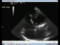 مصنع الصيغCHD15
