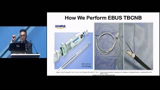EBUS TBNA vs EBUS MEDIASTINAL CRYOBIOPSY -  Dr Eric Daniel Tenda