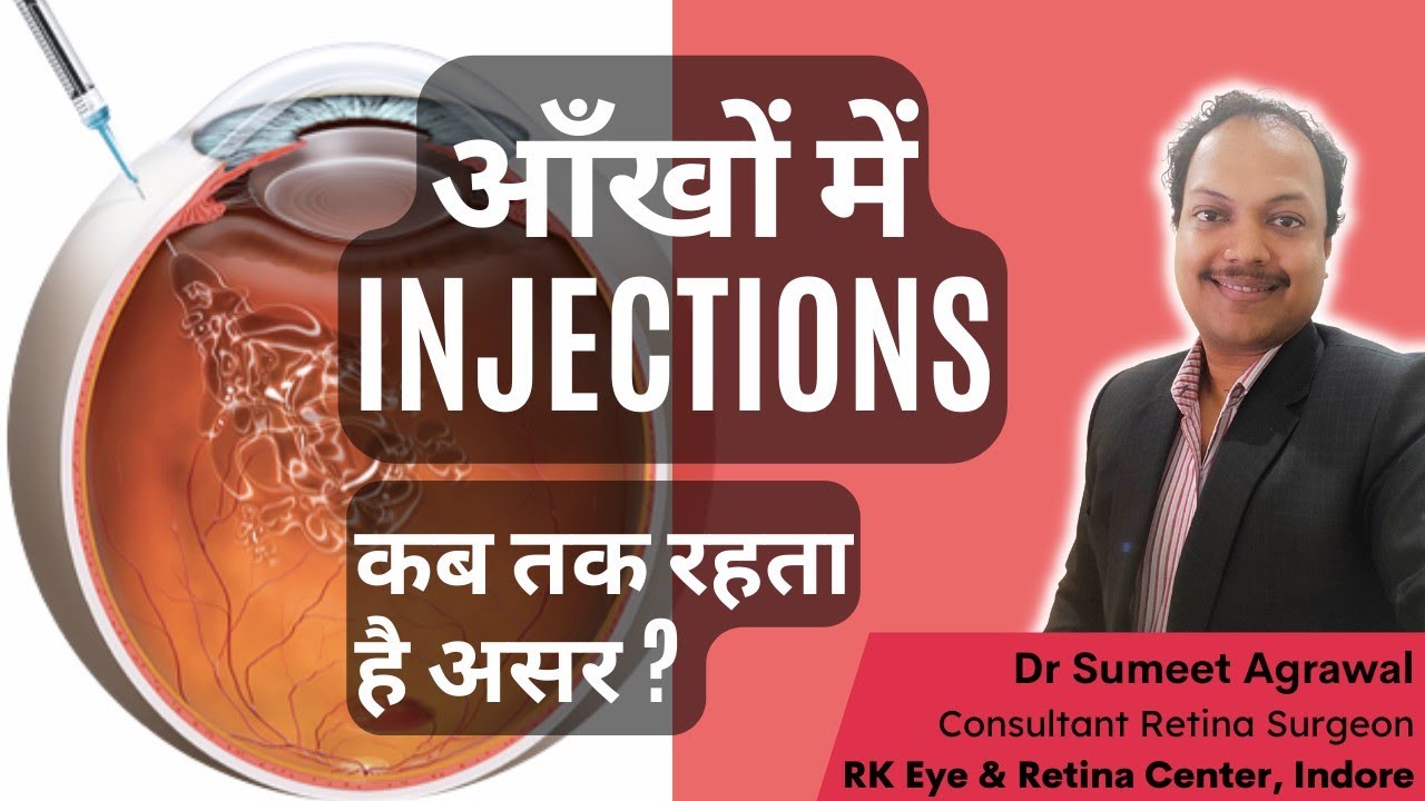 आँखों में INJECTION. कब तक रहता है असर ? - YouTube