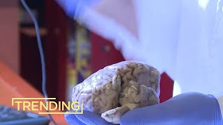 Project Aims to Unravel Mysteries of the Brain