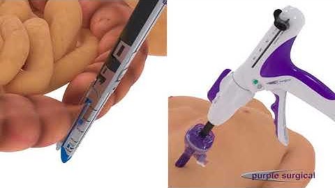 The Ultimate Endoscopic Linear Cutter Stapler on Vimeo1