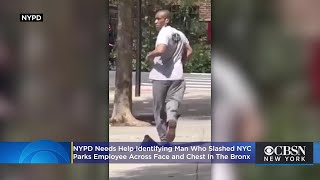 NYC Parks Employee Slashed Across Face And Chest On The Job In The Bronx