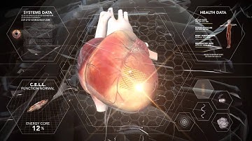 Heart Surgery -Tissue Scaffolding