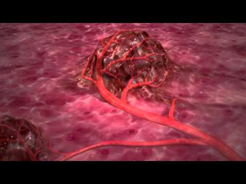 Vídeo: O MiR-22 Suprime A Tumorigênese E Melhora A Radiosensibilidade Das Células Cancerígenas Da Mama, Visando O Sirt1